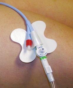 CATH-SECURE MULTI-PURPOSE TUBE HOLDER 2 1/2IN WRAP TAB, BUTTERFLY BASE